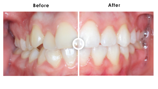 904DentalCare-Ortho_Before_After
